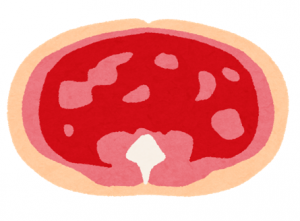 内臓脂肪型肥満とは